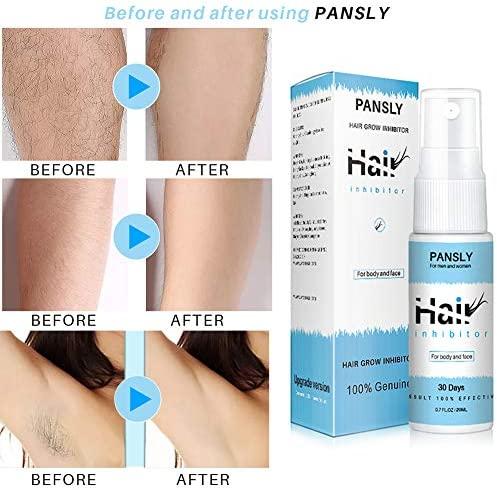 Hair Removal Spray: 15 Top Spays that Remove Hair & Smoothen Skin | Betha  Guide